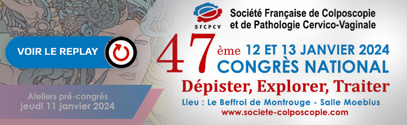 SFCPCV